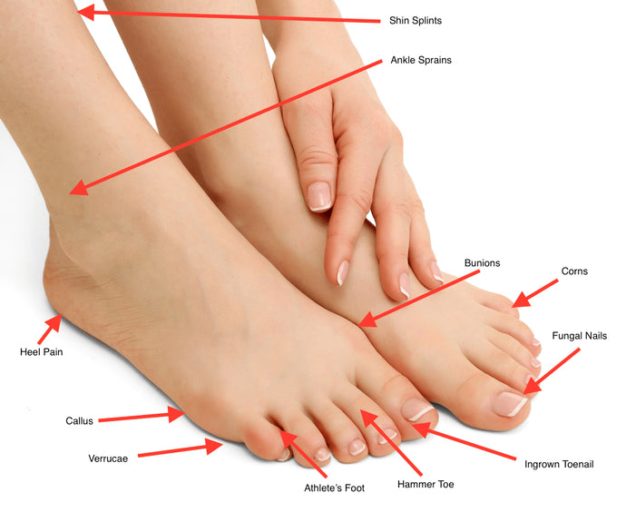 10 Common Foot Problems and Effective Treatment Methods for Relief