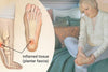 Plantar Fasciitis: Your Comprehensive Guide to Understanding and Managing Heel Pain