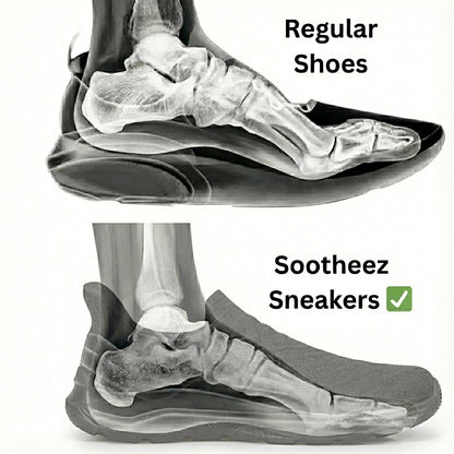 Sootheez FlexSlip Relief Sneaker